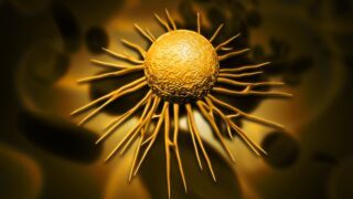 cancer cell أمراض السرطان : بين إمكانية الوقاية وصعوبة العلاج