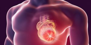 لمحة إعجاز نبوية 0225HeartCancer_SC-300x150