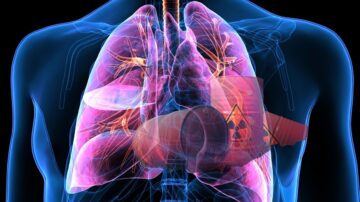 صورة توضيحية لجهاز التنفس البشري، تظهر الرئتين بشكل مفصل مع الأوعية الدموية والأجزاء الداخلية. تتضمن الصورة أيضًا رمز تحذير من المواد الخطرة، مما يشير إلى أهمية حماية الرئتين من الملوثات.