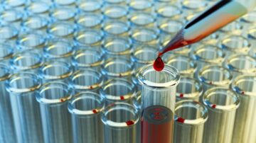 قطرة من سائل أحمر تسقط من أنبوب مختبري على أنبوب اختبار زجاجي وسط مجموعة من أنابيب الاختبار. تعكس الأنابيب الضوء، مما يبرز تفاصيلها الزجاجية. الصورة تعبر عن الأبحاث العلمية والتحاليل المخبرية.