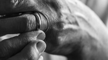 يد تُظهر إصبعًا يلمس خاتم زواج، مع تفاصيل واضحة عن التجاعيد والملمس. تعكس الصورة مشاعر الحنين والارتباط.