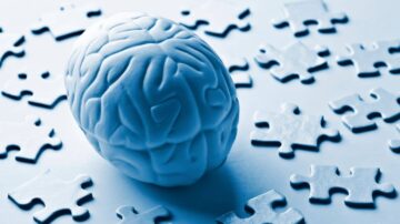 دماغ أبيض مركزي محاط بقطع أحجية بيضاء. تعكس الصورة مفهوم التفكير والتحليل وحل المشكلات.